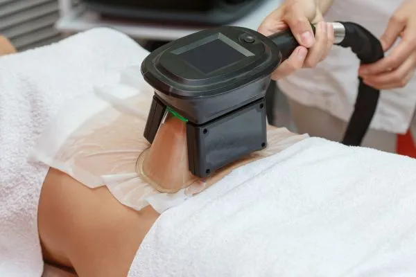 Image of person having fat freezing treatment to help weight gain Cribbs Causeway